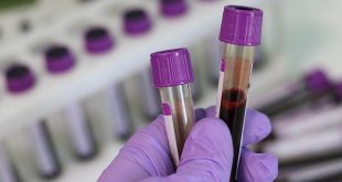 Un laborator de analize din Ploieşti va face teste de sânge pentru identificarea anticorpilor anti SARS-CoV-2 IgG si anti COVID-19